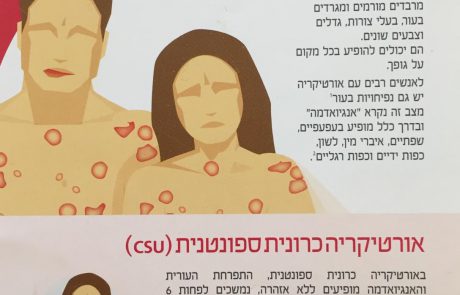 מהי אורטיקריה?